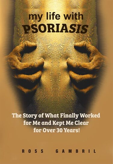 The Book That Tells How to Clear Up Psoriasis